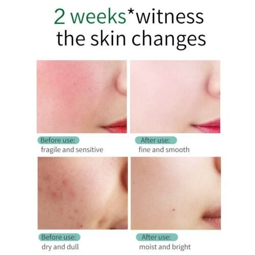 SKIN EVER Centella Repair Face Cream Moisturizing and Moisturizing Repair Facial Skin Face Cream Skin Care Product SK017 - Image 5